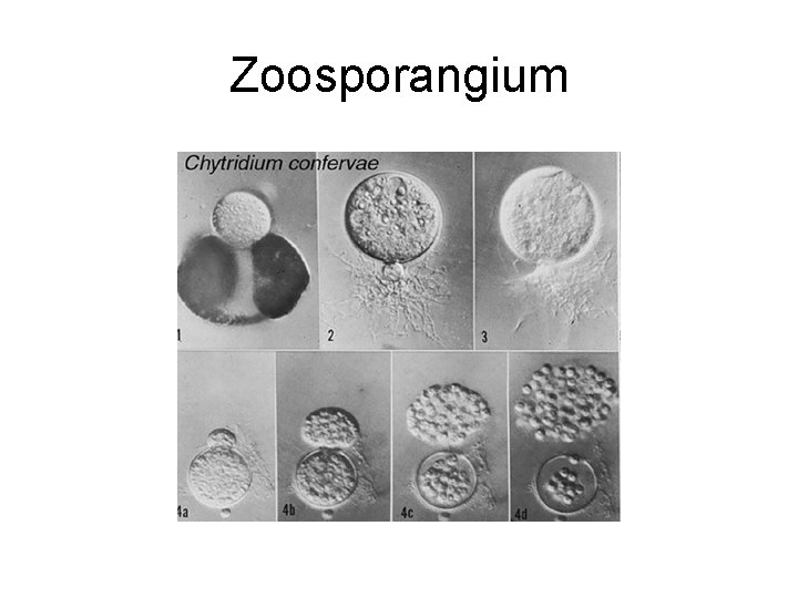 Zoosporangium 