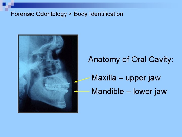 Forensic Odontology > Body Identification Anatomy of Oral Cavity: Maxilla – upper jaw Mandible