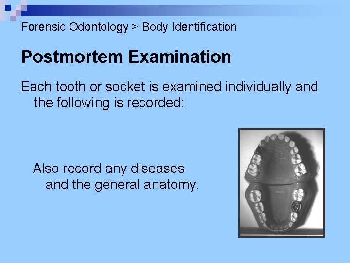 Forensic Odontology > Body Identification Postmortem Examination Each tooth or socket is examined individually
