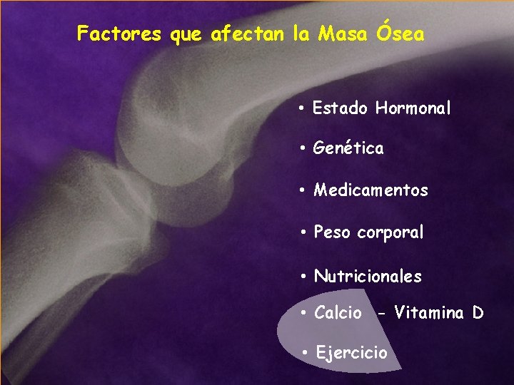 Factores que afectan la Masa Ósea • Estado Hormonal • Genética • Medicamentos •