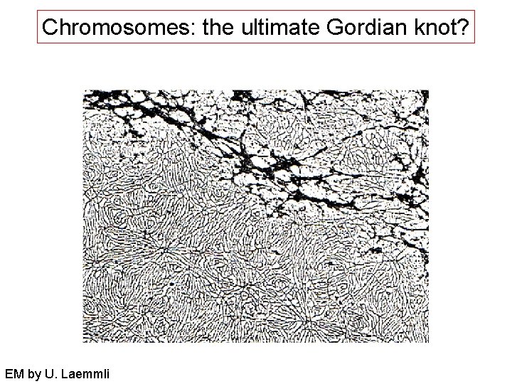 Chromosomes: the ultimate Gordian knot? EM by U. Laemmli 