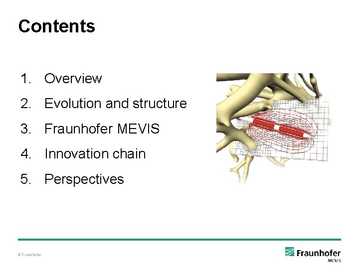 Contents 1. Overview 2. Evolution and structure 3. Fraunhofer MEVIS 4. Innovation chain 5. Contents 1. Overview 2. Evolution and structure 3. Fraunhofer MEVIS 4. Innovation chain 5.