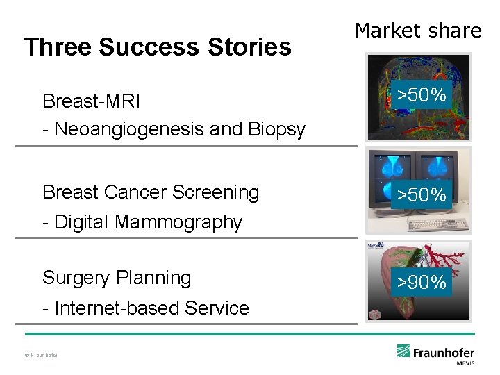 Three Success Stories Market share Breast-MRI - Neoangiogenesis and Biopsy >50% Breast Cancer Screening Three Success Stories Market share Breast-MRI - Neoangiogenesis and Biopsy >50% Breast Cancer Screening