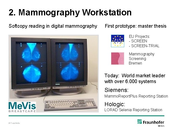 2. Mammography Workstation Softcopy reading in digital mammography First prototype: master thesis EU Projects: 2. Mammography Workstation Softcopy reading in digital mammography First prototype: master thesis EU Projects: