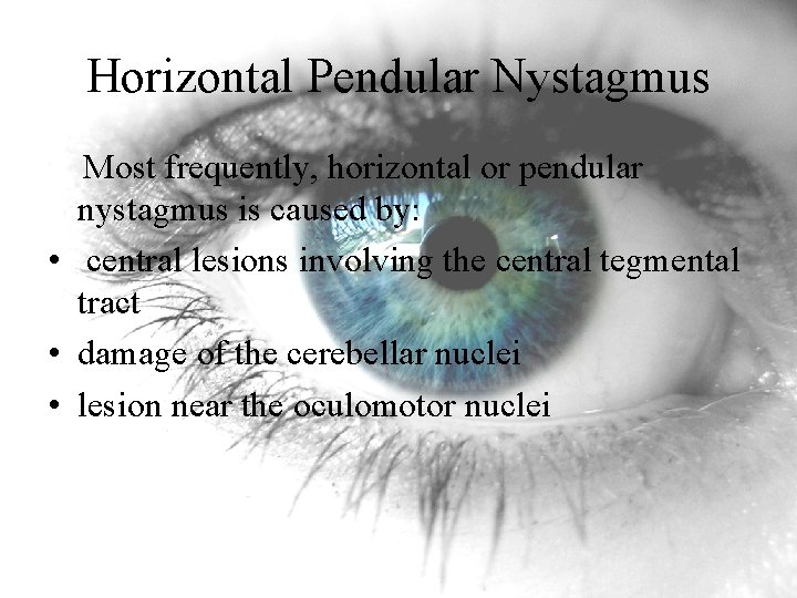 Horizontal Pendular Nystagmus Most frequently, horizontal or pendular nystagmus is caused by: • central Horizontal Pendular Nystagmus Most frequently, horizontal or pendular nystagmus is caused by: • central
