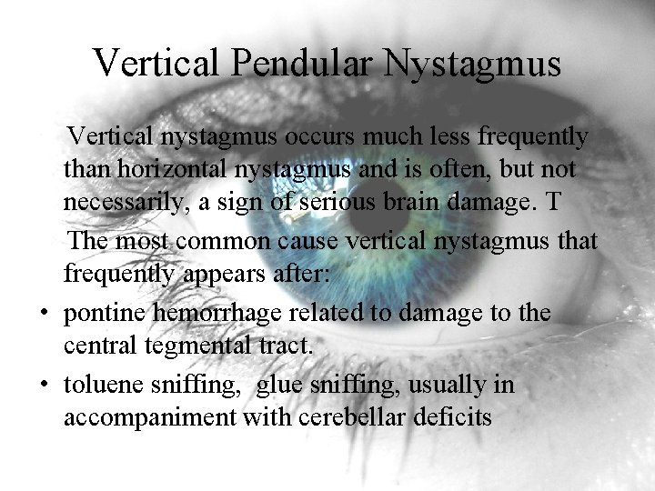 Vertical Pendular Nystagmus Vertical nystagmus occurs much less frequently than horizontal nystagmus and is Vertical Pendular Nystagmus Vertical nystagmus occurs much less frequently than horizontal nystagmus and is
