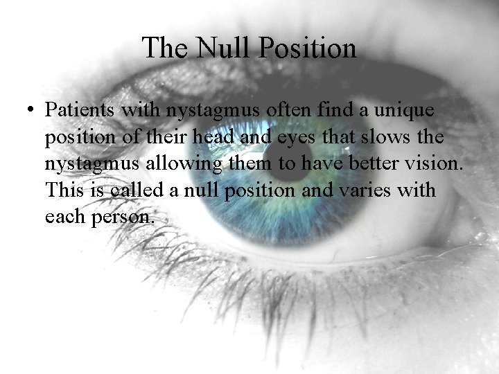 The Null Position • Patients with nystagmus often find a unique position of their The Null Position • Patients with nystagmus often find a unique position of their