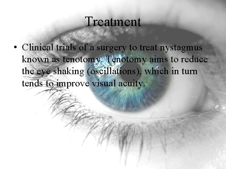 Treatment • Clinical trials of a surgery to treat nystagmus known as tenotomy. Tenotomy Treatment • Clinical trials of a surgery to treat nystagmus known as tenotomy. Tenotomy
