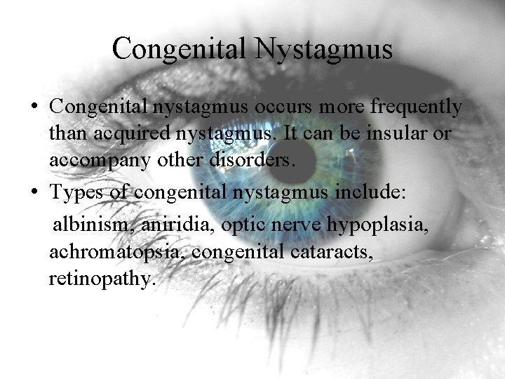 Congenital Nystagmus • Congenital nystagmus occurs more frequently than acquired nystagmus. It can be Congenital Nystagmus • Congenital nystagmus occurs more frequently than acquired nystagmus. It can be