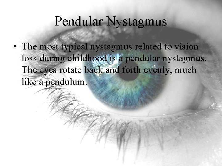 Pendular Nystagmus • The most typical nystagmus related to vision loss during childhood is Pendular Nystagmus • The most typical nystagmus related to vision loss during childhood is