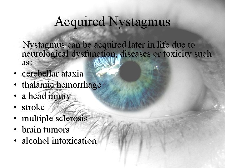 Acquired Nystagmus can be acquired later in life due to neurological dysfunction, diseases or Acquired Nystagmus can be acquired later in life due to neurological dysfunction, diseases or