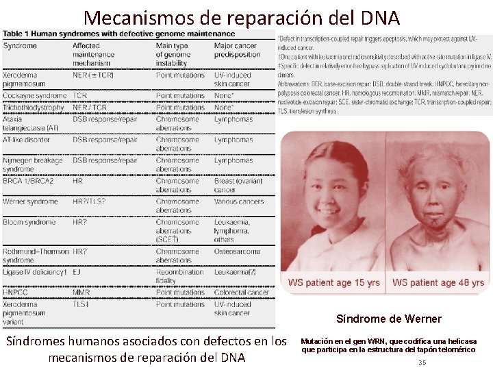 Mecanismos de reparación del DNA Síndrome de Werner Síndromes humanos asociados con defectos en