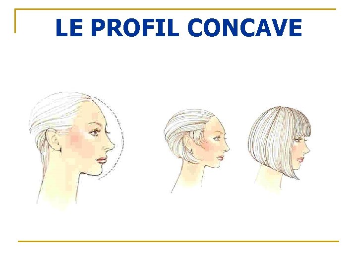 LE PROFIL CONCAVE 