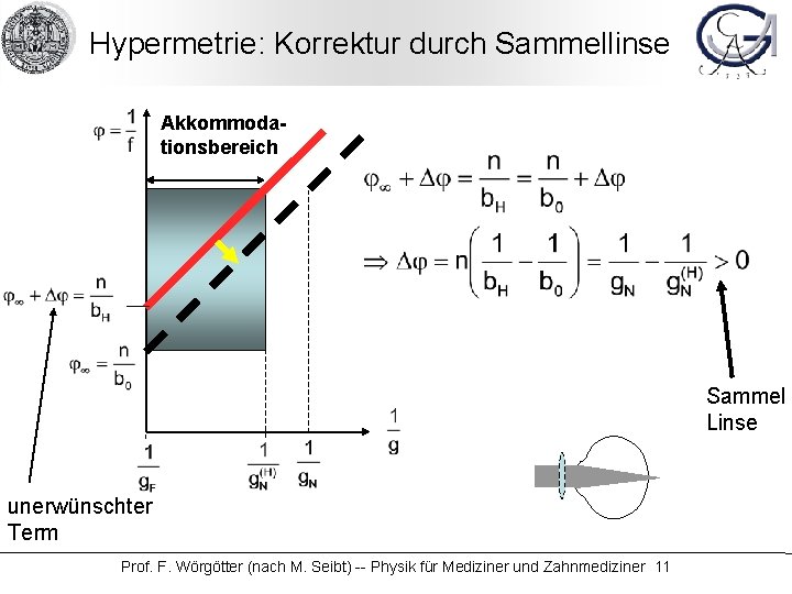 Hypermetrie: Korrektur durch Sammellinse Akkommodationsbereich Sammel Linse unerwünschter Term Prof. F. Wörgötter (nach M.