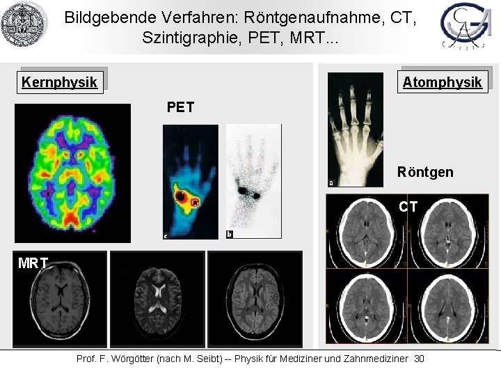 Bildgebende Verfahren: Röntgenaufnahme, CT, Szintigraphie, PET, MRT. . . Atomphysik Kernphysik PET Röntgen CT