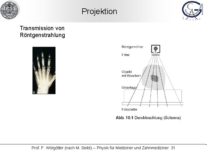 Projektion Transmission von Röntgenstrahlung Prof. F. Wörgötter (nach M. Seibt) -- Physik für Mediziner