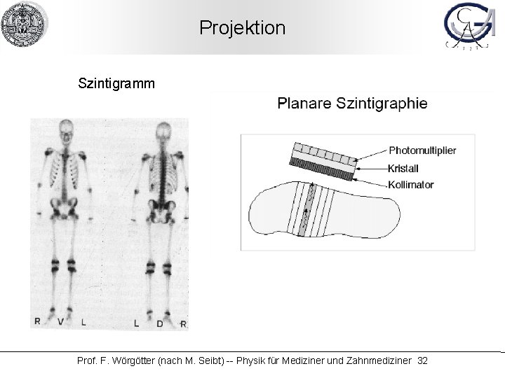 Projektion Szintigramm Prof. F. Wörgötter (nach M. Seibt) -- Physik für Mediziner und Zahnmediziner