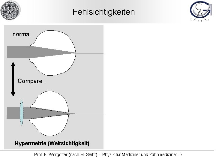 Fehlsichtigkeiten normal Compare ! Hypermetrie (Weitsichtigkeit) Compare ! Myopie (Kurzsichtigkeit) Prof. F. Wörgötter (nach