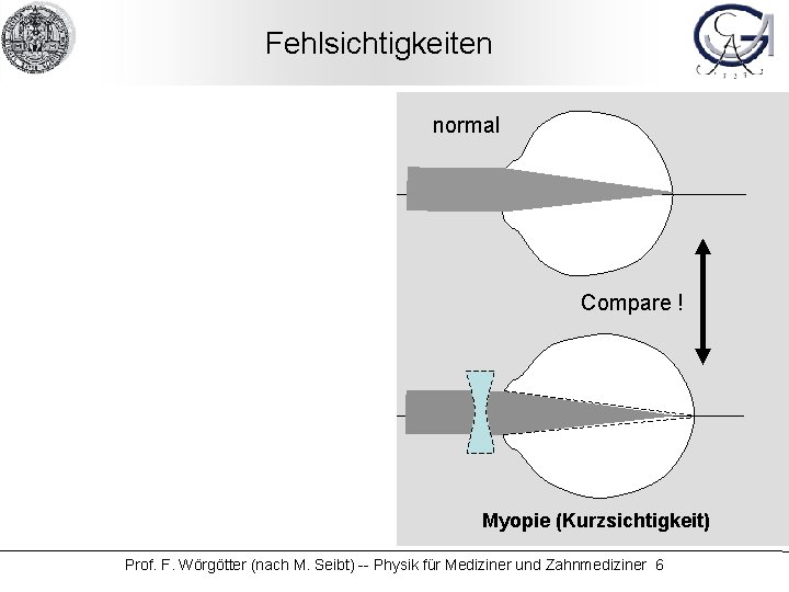 Fehlsichtigkeiten normal Compare ! Hypermetrie (Weitsichtigkeit) Compare ! Myopie (Kurzsichtigkeit) Prof. F. Wörgötter (nach