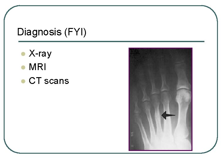 Diagnosis (FYI) l l l X-ray MRI CT scans 