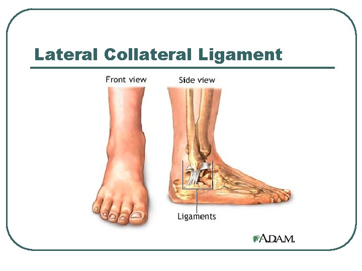 Lateral Collateral Ligament 