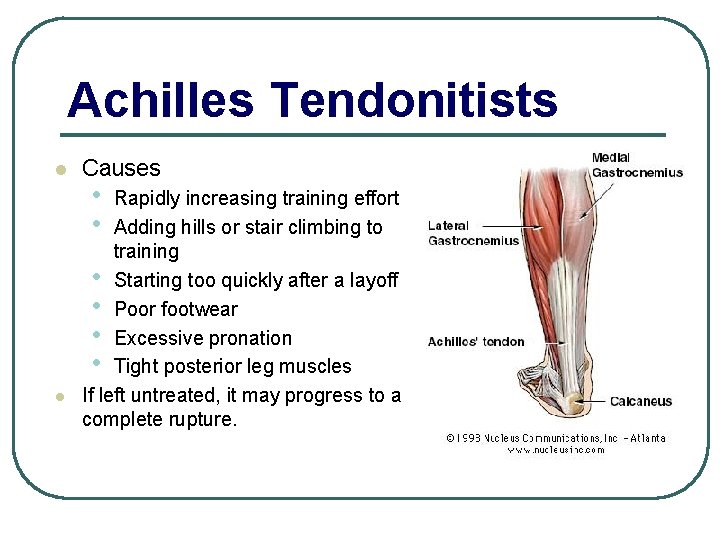 Achilles Tendonitists l l Causes • • Rapidly increasing training effort Adding hills or