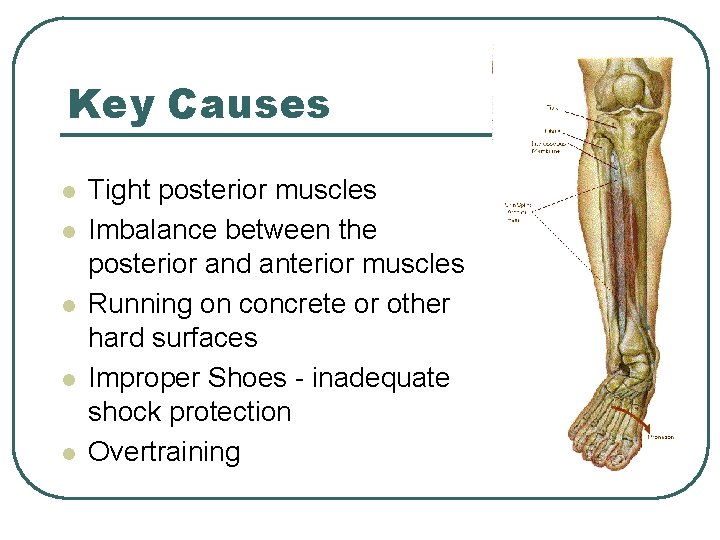 Key Causes l l l Tight posterior muscles Imbalance between the posterior and anterior