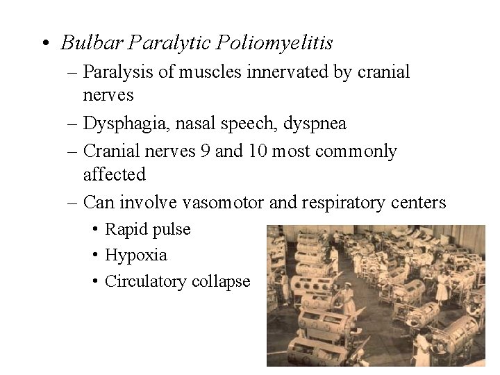  • Bulbar Paralytic Poliomyelitis – Paralysis of muscles innervated by cranial nerves –