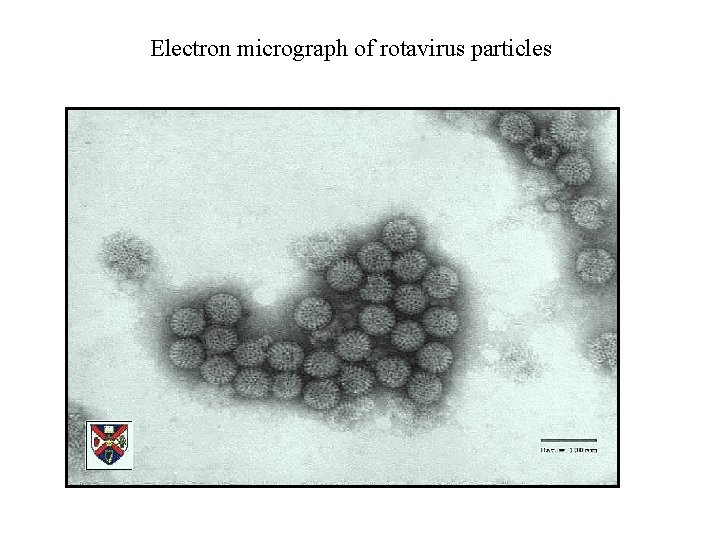 Electron micrograph of rotavirus particles 