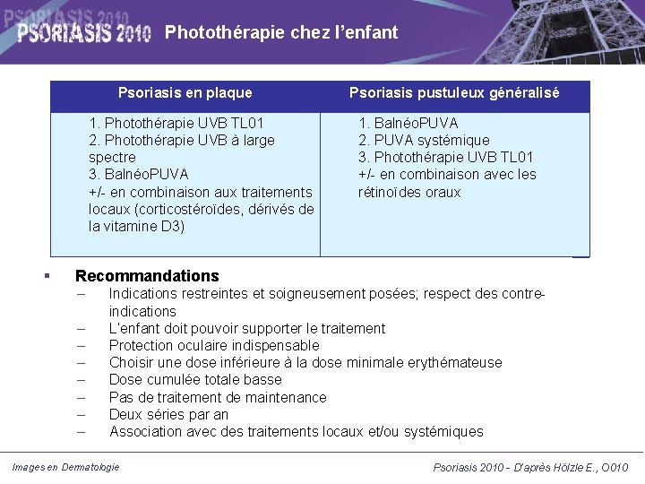 Photothérapie chez l’enfant Psoriasis en plaque 1. Photothérapie UVB TL 01 2. Photothérapie UVB