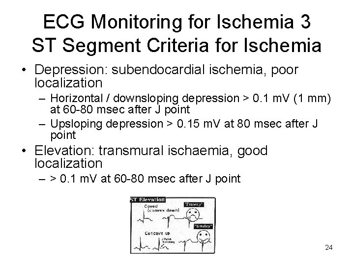 ECG Monitoring for Ischemia 3 ST Segment Criteria for Ischemia • Depression: subendocardial ischemia,