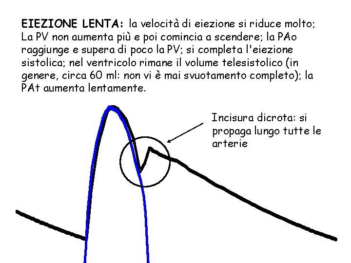 EIEZIONE LENTA: la velocità di eiezione si riduce molto; La PV non aumenta più