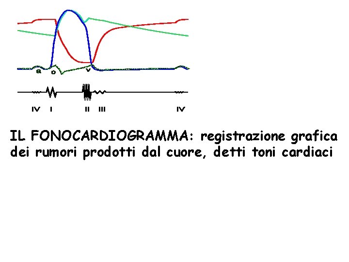 IL FONOCARDIOGRAMMA: registrazione grafica dei rumori prodotti dal cuore, detti toni cardiaci 