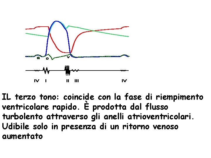 IL terzo tono: coincide con la fase di riempimento ventricolare rapido. È prodotta dal