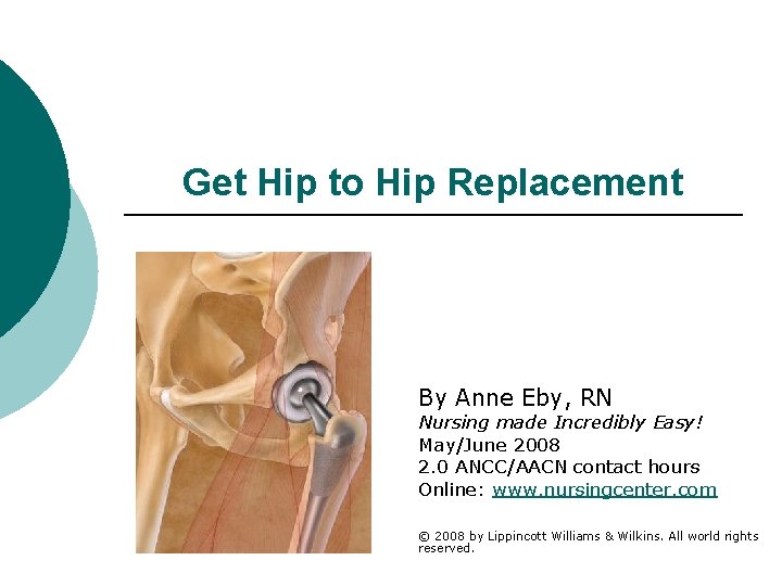 Get Hip to Hip Replacement By Anne Eby, RN Nursing made Incredibly Easy! May/June