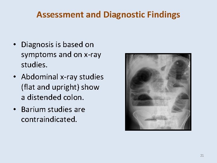 Assessment and Diagnostic Findings • Diagnosis is based on symptoms and on x-ray studies.