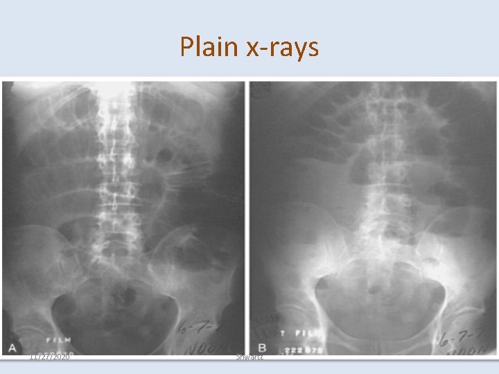 Plain x-rays 11/27/2020 Shwartz 