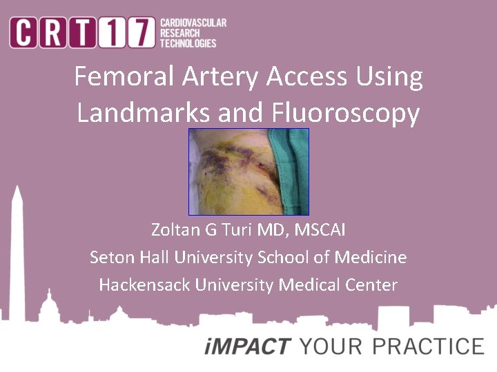 Femoral Artery Access Using Landmarks and Fluoroscopy Zoltan G Turi MD, MSCAI Seton Hall