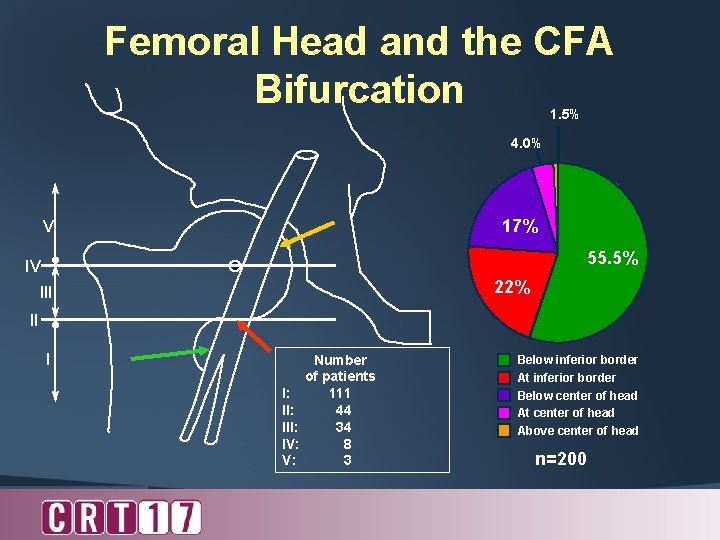 Femoral Head and the CFA Bifurcation 1. 5% 4. 0% 17% V 55. 5%