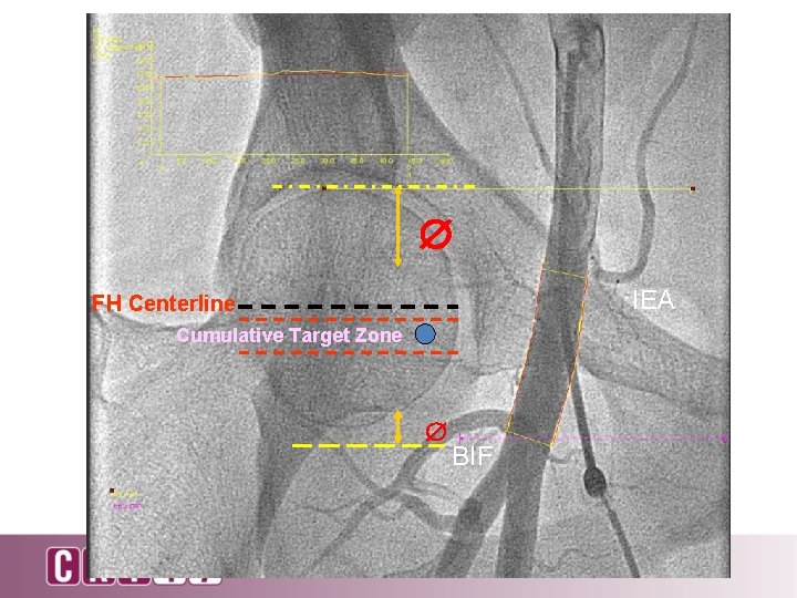  IEA FH Centerline Cumulative Target Zone BIF 