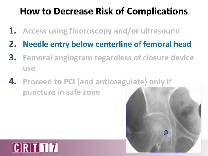 How to Decrease Risk of Complications 1. Access using fluoroscopy and/or ultrasound 2. Needle