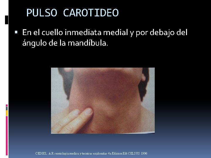 PULSO CAROTIDEO En el cuello inmediata medial y por debajo del ángulo de la