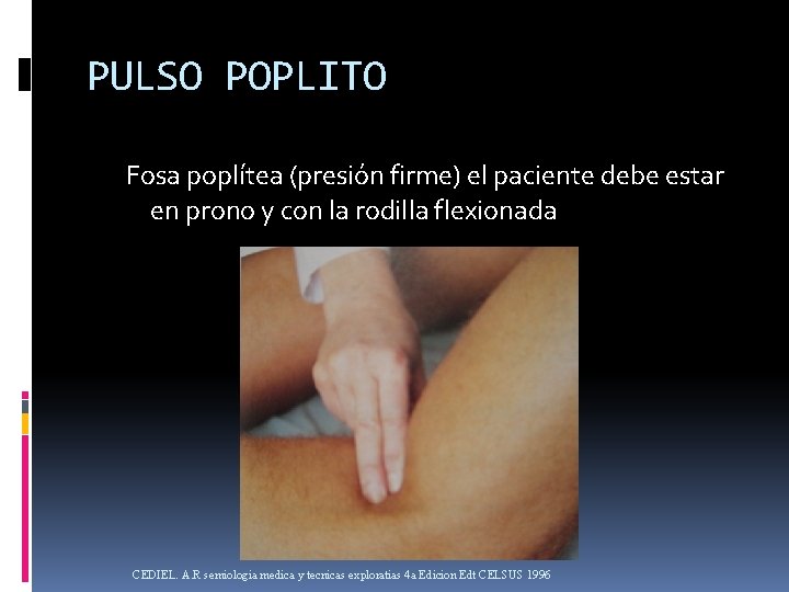 PULSO POPLITO Fosa poplítea (presión firme) el paciente debe estar en prono y con