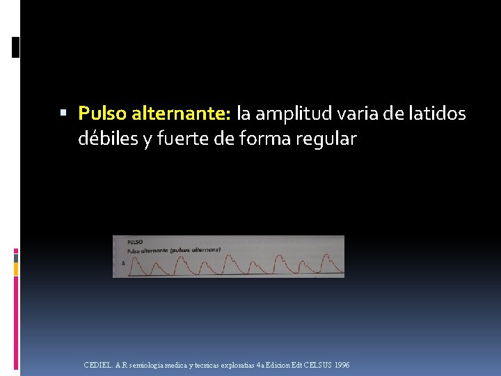  Pulso alternante: la amplitud varia de latidos débiles y fuerte de forma regular