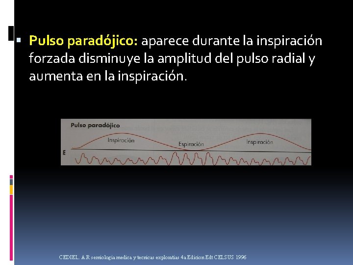 Pulso paradójico: aparece durante la inspiración forzada disminuye la amplitud del pulso radial