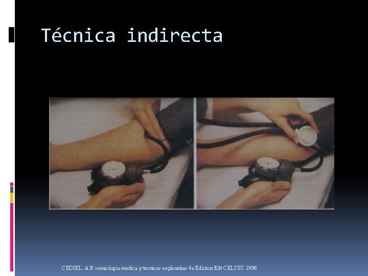 Técnica indirecta CEDIEL. A. R semiologia medica y tecnicas exploratias 4 a Edicion Edt