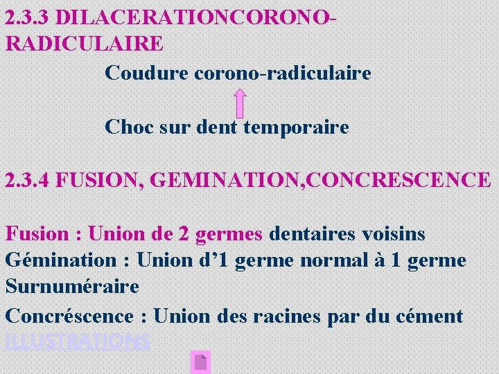 2. 3. 3 DILACERATIONCORONORADICULAIRE Coudure corono-radiculaire Choc sur dent temporaire 2. 3. 4 FUSION,