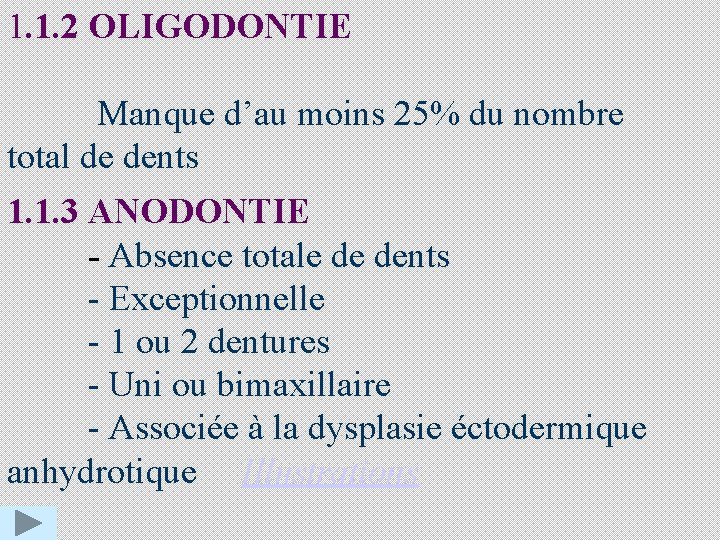 1. 1. 2 OLIGODONTIE Manque d’au moins 25% du nombre total de dents 1.