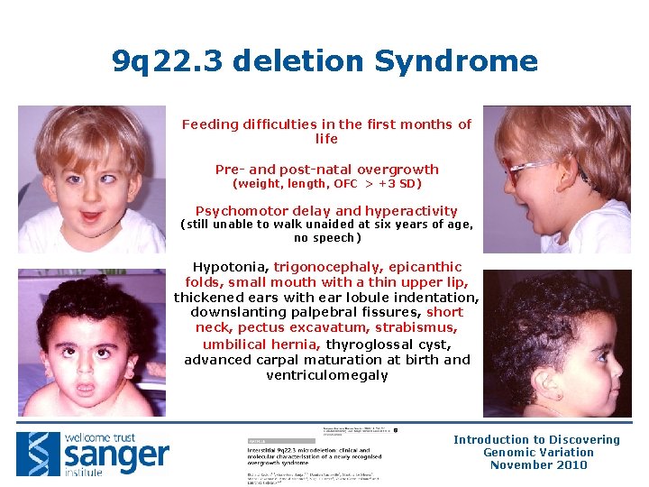 9 q 22. 3 deletion Syndrome Feeding difficulties in the first months of life 9 q 22. 3 deletion Syndrome Feeding difficulties in the first months of life