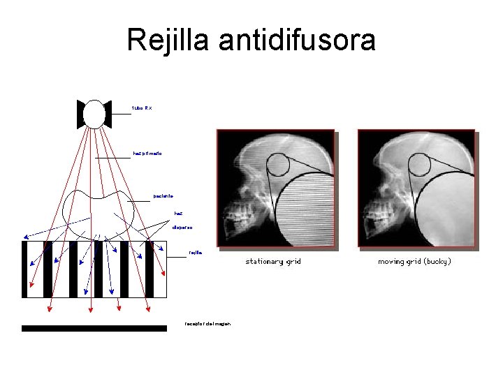 Rejilla antidifusora tubo RX haz primario paciente haz disperso rejilla receptor de imagen 